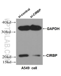 CIRBP Polyclonal antibody proteintech 10209-2-AP