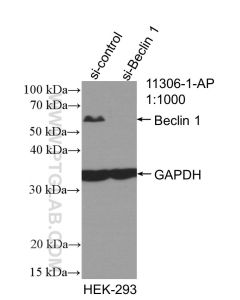 Beclin 1 Polyclonal antibody proteintech 11306-1-AP
