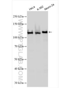 Drebrin Polyclonal antibody proteintech 10260-1-AP