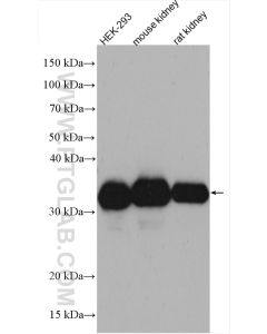 LDHA Polyclonal antibody proteintech 21799-1-AP