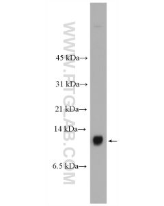 S100A14 Polyclonal antibody proteintech 10489-1-AP
