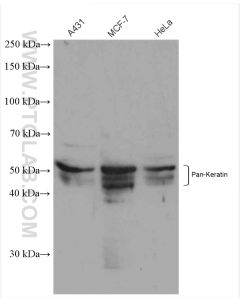 Pan-Keratin Polyclonal antibody proteintech 26411-1-AP