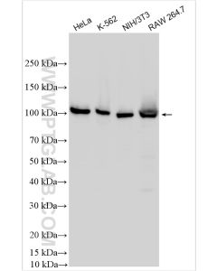 NFKB2,p100 Polyclonal antibody proteintech 10409-2-AP
