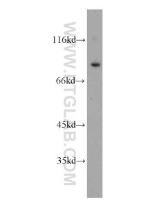 ODF2 Polyclonal antibody proteintech 12058-1-AP