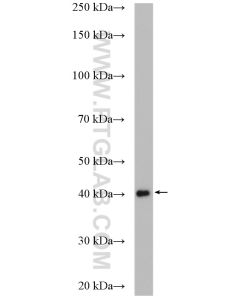 BBS5 Polyclonal antibody proteintech 14569-1-AP