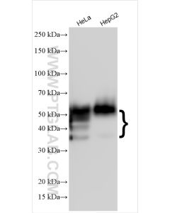 CD147 Polyclonal antibody proteintech 11989-1-AP