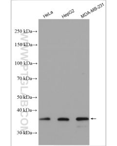 OMA1 Polyclonal antibody proteintech 17116-1-AP