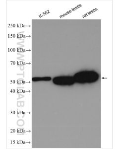 ALDH2 Polyclonal antibody proteintech 15310-1-AP