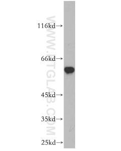 cIAP1 Polyclonal antibody proteintech 10022-1-AP
