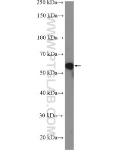 E2F1 Polyclonal antibody proteintech 12171-1-AP