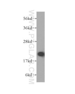 RPL11 Polyclonal antibody proteintech 16277-1-AP