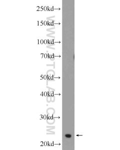 TPPP Polyclonal antibody proteintech 25040-1-AP