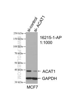ACAT1 Polyclonal antibody proteintech 16215-1-AP