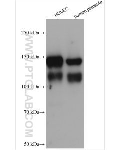 VE-cadherin/CD144 Polyclonal antibody proteintech 27956-1-AP
