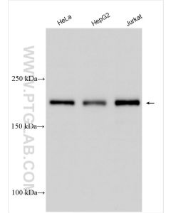 DNMT1 Polyclonal antibody proteintech 24206-1-AP