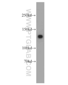 MYLK Polyclonal antibody proteintech 21642-1-AP