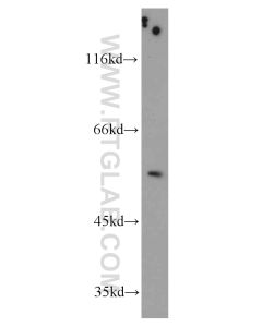 TRIM44 Polyclonal antibody proteintech 11511-1-AP