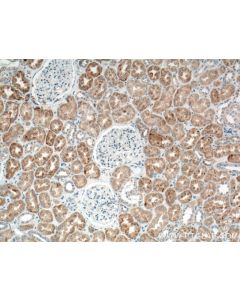 TIMP2 Polyclonal antibody proteintech 17353-1-AP