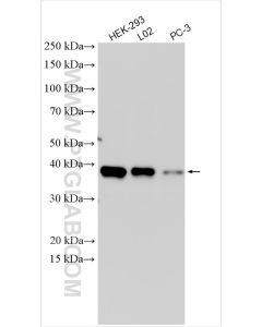 SIX2 Polyclonal antibody proteintech 11562-1-AP