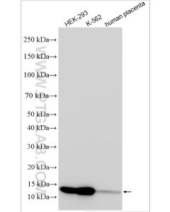 LSM2 Polyclonal antibody proteintech 32074-1-AP