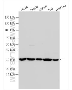 NSMCE1 Polyclonal antibody proteintech 32113-1-AP