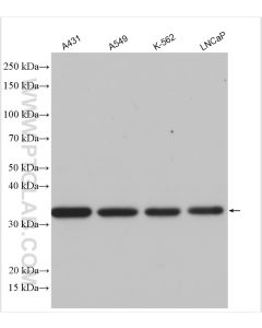 REDD1 specific Polyclonal antibody proteintech 10638-1-AP