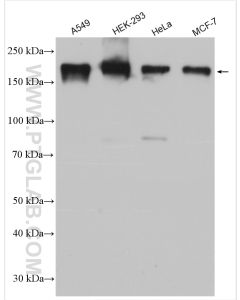 PARD3 Polyclonal antibody proteintech 11085-1-AP