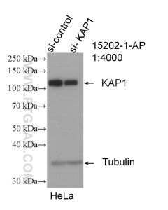 KAP1 Polyclonal antibody proteintech 15202-1-AP