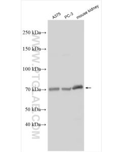 TM9SF4 Polyclonal antibody proteintech 29520-1-AP