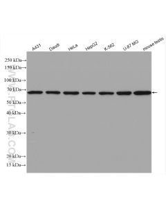 ATP6V1A Polyclonal antibody proteintech 17115-1-AP
