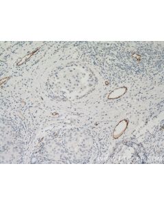 VWF Monoclonal antibody proteintech 66682-1-Ig