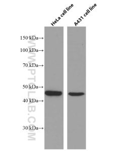 CCRL2 Monoclonal antibody proteintech 66611-1-Ig