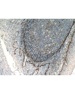 Podoplanin Monoclonal antibody proteintech 67432-1-Ig