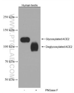 ACE2 Monoclonal antibody proteintech 66699-1-Ig
