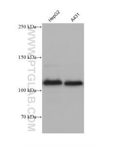 E-cadherin Monoclonal antibody proteintech 60902-1-Ig