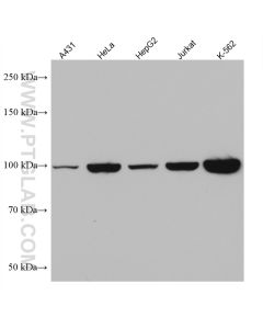 Alix Monoclonal antibody proteintech 67715-1-Ig
