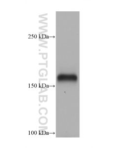 CD11a Monoclonal antibody proteintech 66256-1-Ig