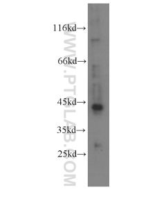 RXRA Monoclonal antibody proteintech 60198-1-Ig