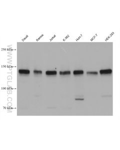 PERK/EIF2AK3 Monoclonal antibody proteintech 68482-1-Ig