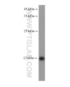 S100A10 Monoclonal antibody proteintech 66227-1-Ig