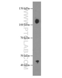 CBLB Monoclonal antibody proteintech 66353-1-Ig