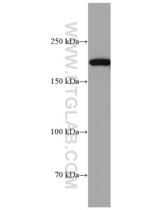 CUL7 Monoclonal antibody proteintech 67034-1-Ig