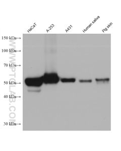Cytokeratin 5 Monoclonal antibody proteintech 66727-1-Ig