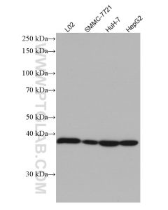 ADH1B Monoclonal antibody proteintech 66939-1-Ig