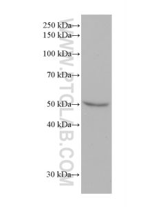 CYP2E1-Specific Monoclonal antibody proteintech 67263-1-Ig