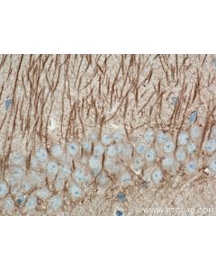 MAP2 Monoclonal antibody proteintech 67015-1-Ig