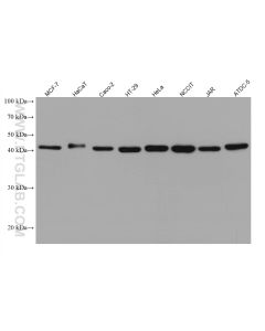 SLC30A2 Monoclonal antibody proteintech 67993-1-Ig