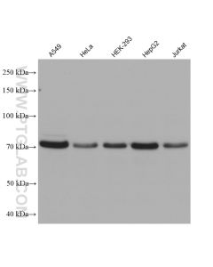 HRD1/SYVN1 Monoclonal antibody proteintech 67488-1-Ig