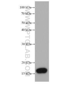 AGR2 Monoclonal antibody proteintech 66768-1-Ig