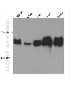 Laminin beta 1 Monoclonal antibody proteintech 67705-1-Ig